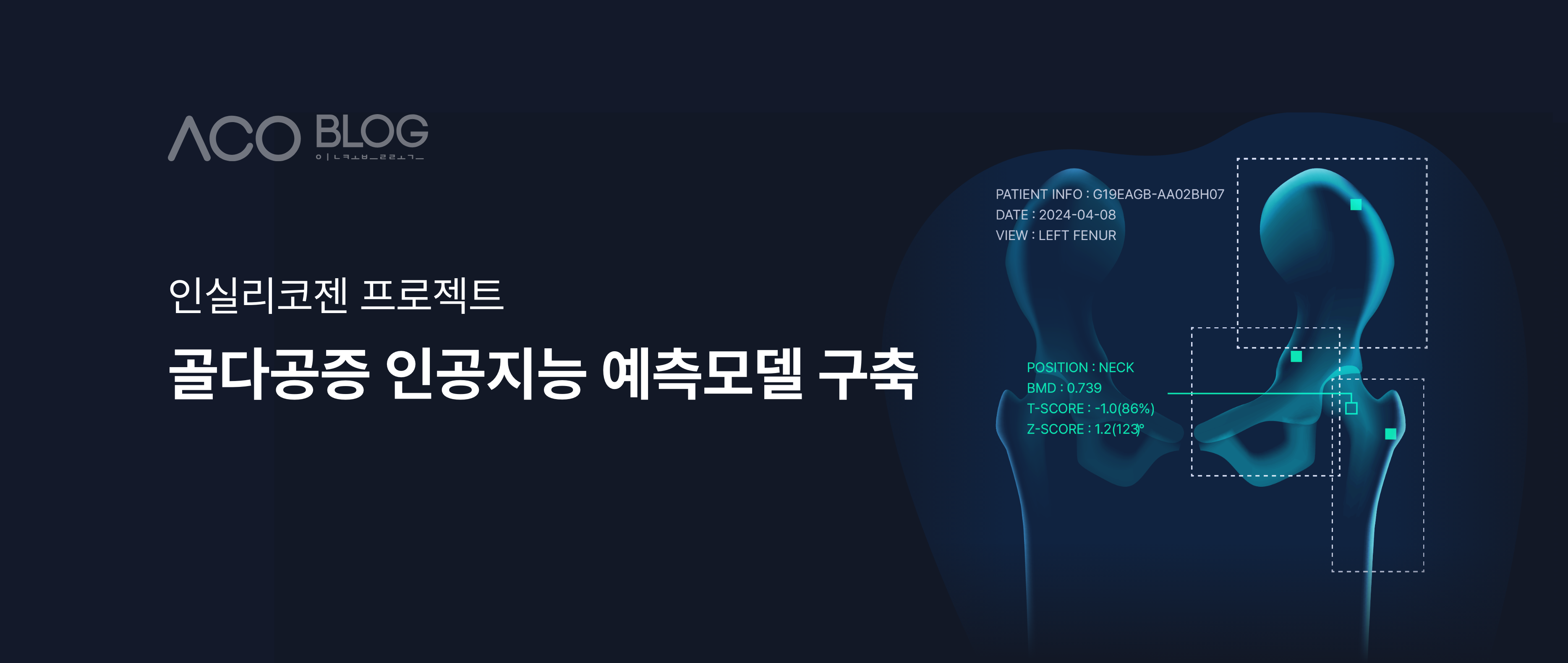 골다공증