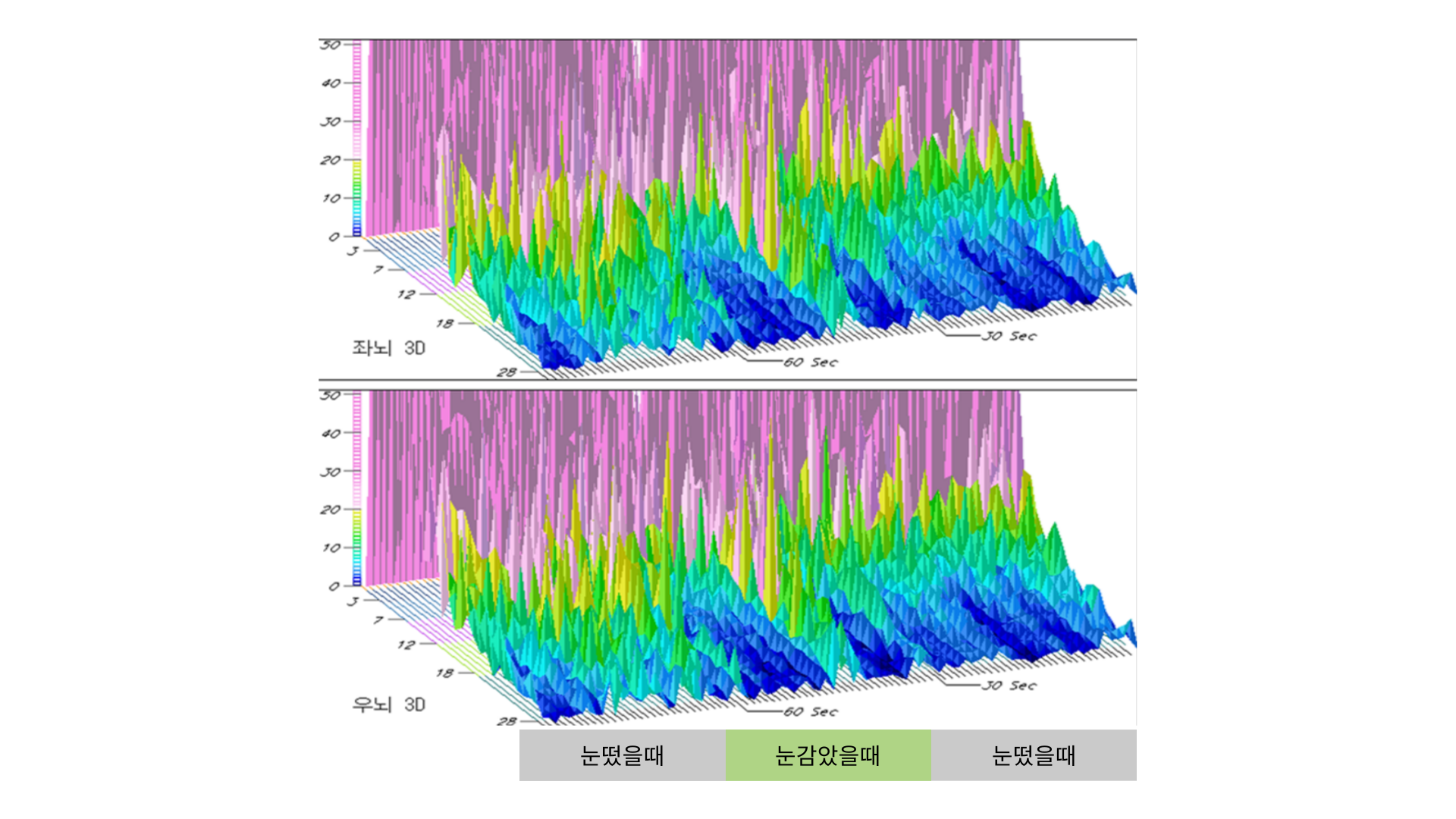 뇌파감사_5분검사_세타파