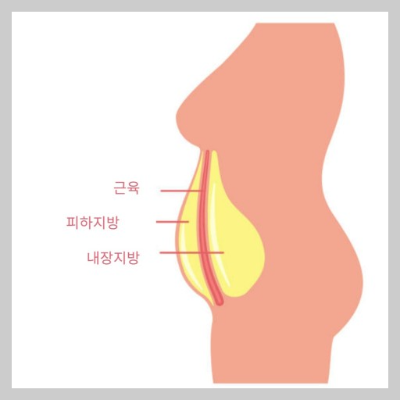 내장지방