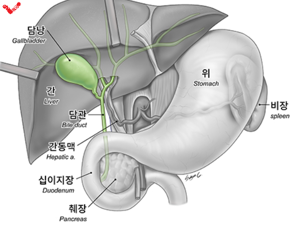 담낭담도