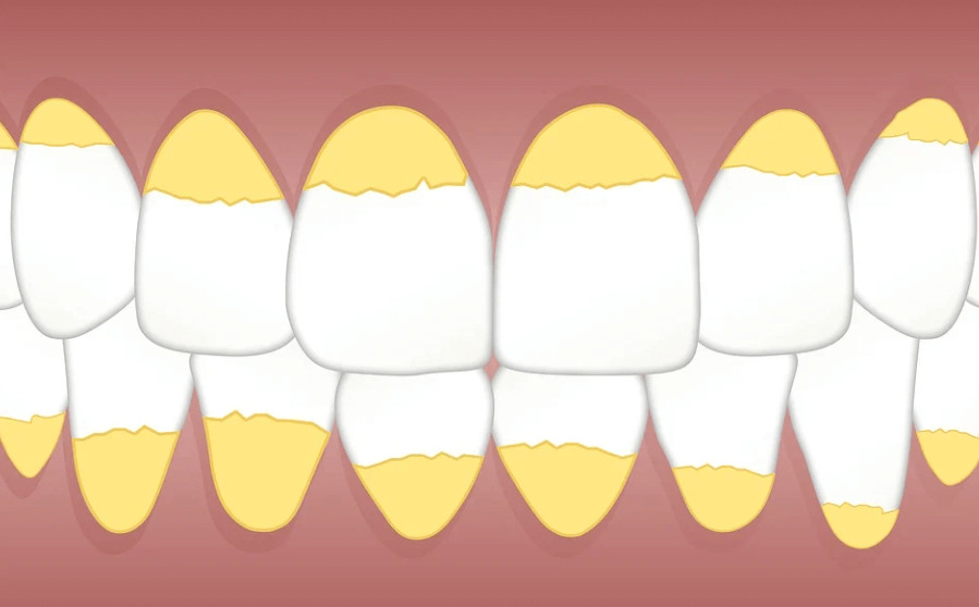 치아사진 