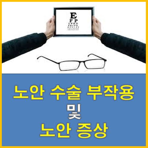  노안수술 부작용 및 노안 증상
