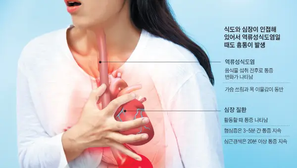윗가슴 통증