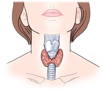 갑상선 기능 저하증 증상에 좋은 음식 원인&amp;#44;치료방법