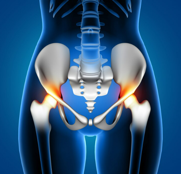 사타구니 통증&#44; 고관절염