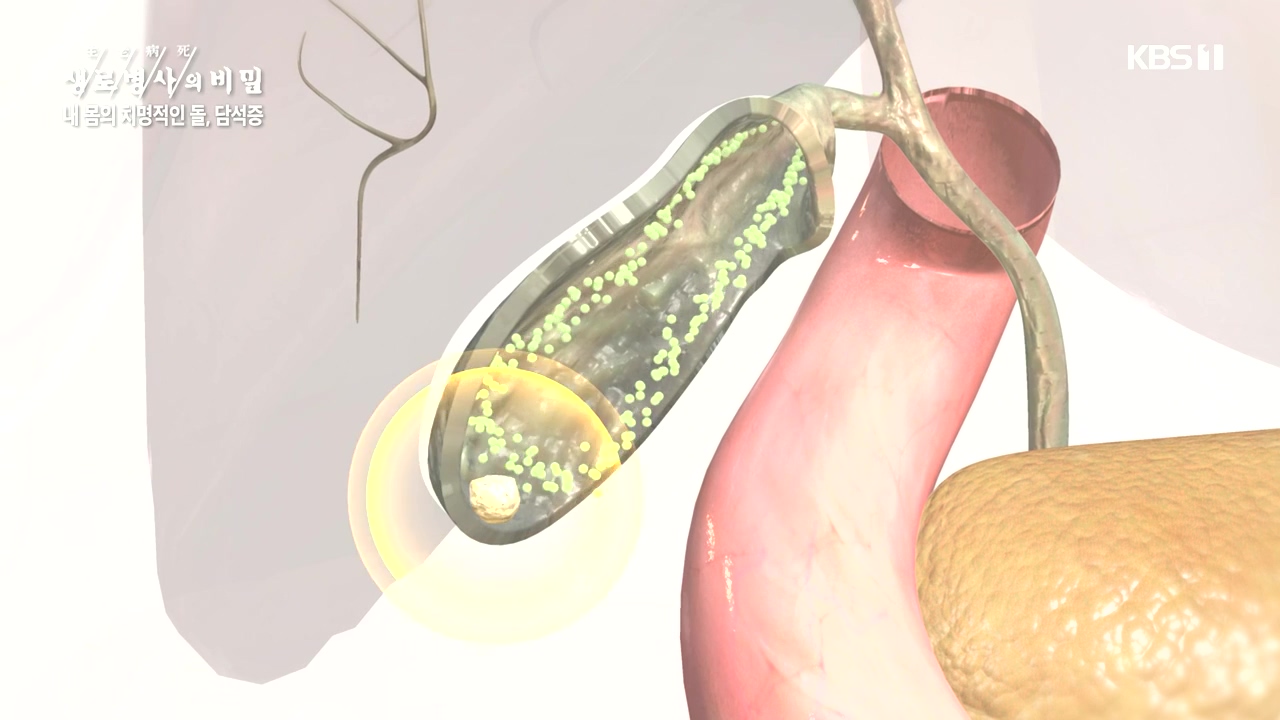 생로병사의 비밀.E886.231019p-NEXT.mp4_20231019_201728.051.jpg