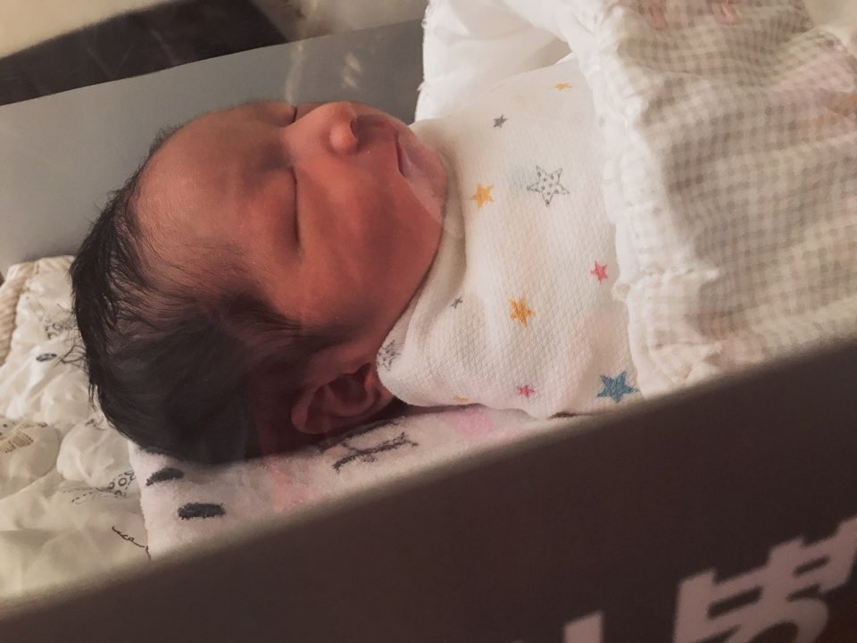 치료 너무 걱정하지 마세요 신생아 황달 원인과 수치, 2