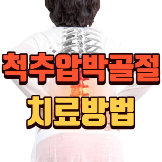  척추압박골절 치료방법 쉽게 정리했어요