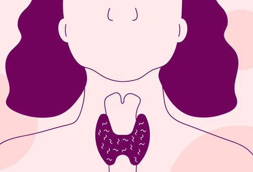  갑상선 기능 저하증 셀레늄, 항진증은 양배추, 토마토가 좋아