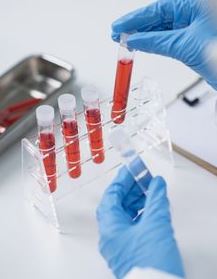 대상포진-백신-접종방법