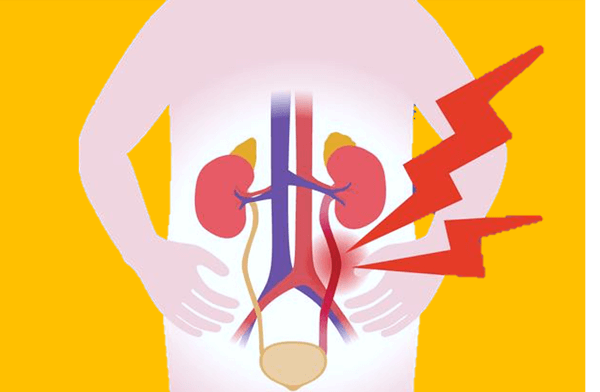방광과 요로&#44; 신장에 통증이 있는 그림