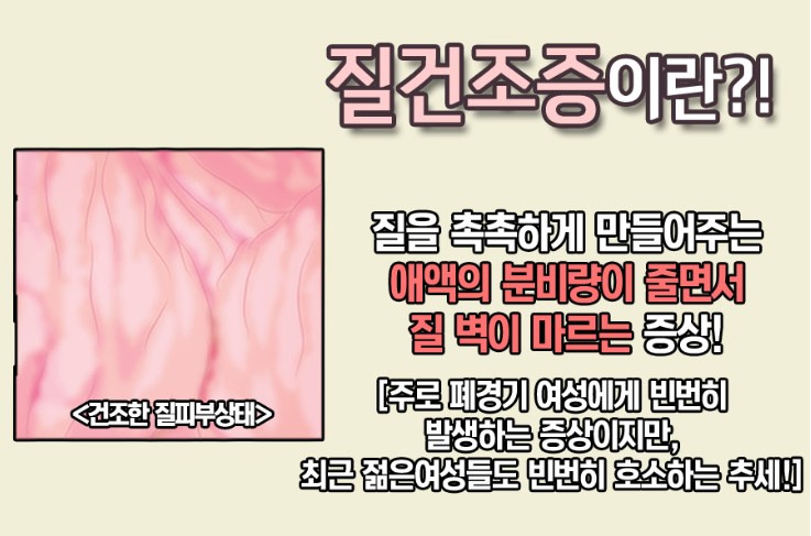 50대 폐경기 갱년기 여성을 괴롭히는 질건조증&#44; 효과적인 예방법과 치료법은?