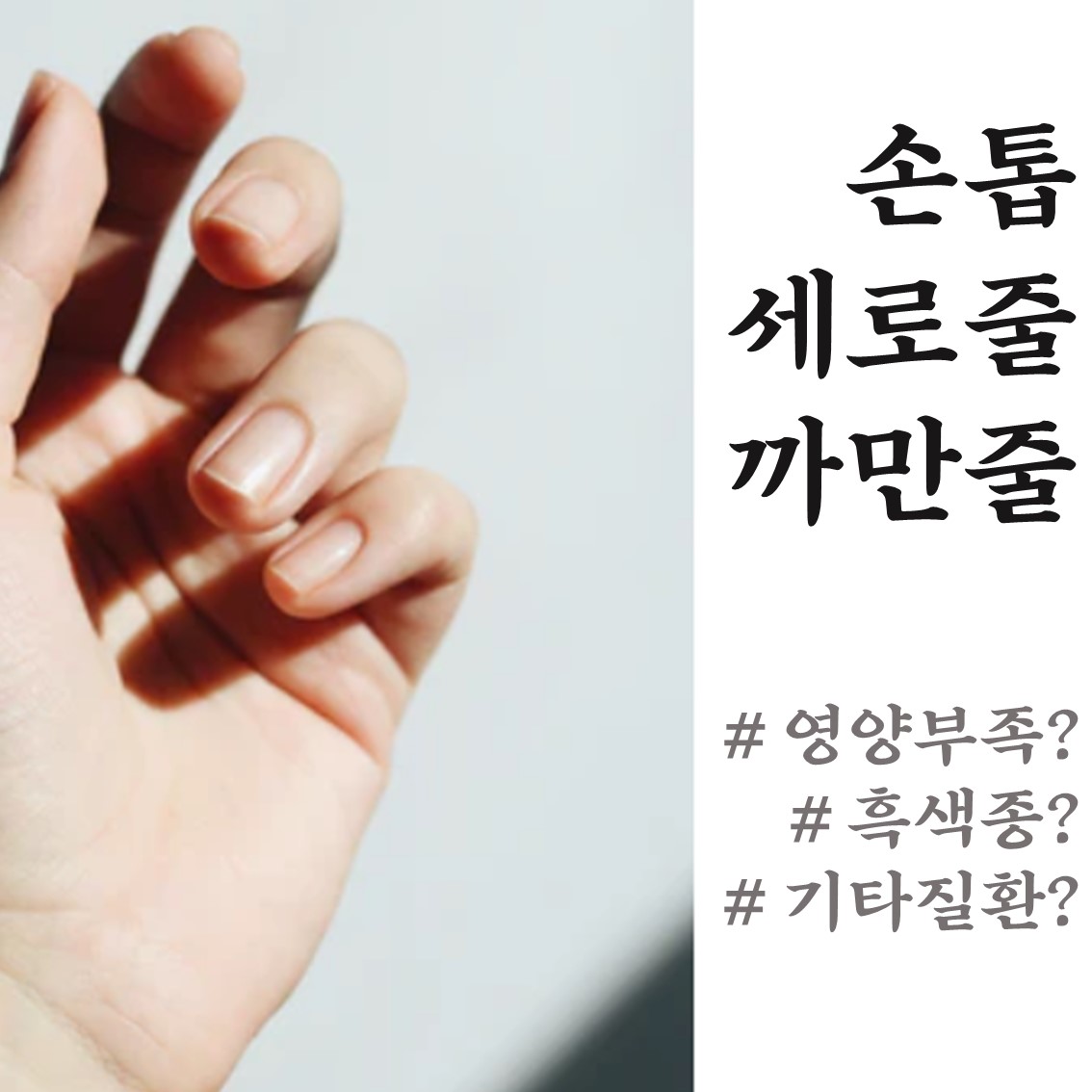  손톱 검은 세로줄 단백질 부족? 흑색종? 자세히 알아보기