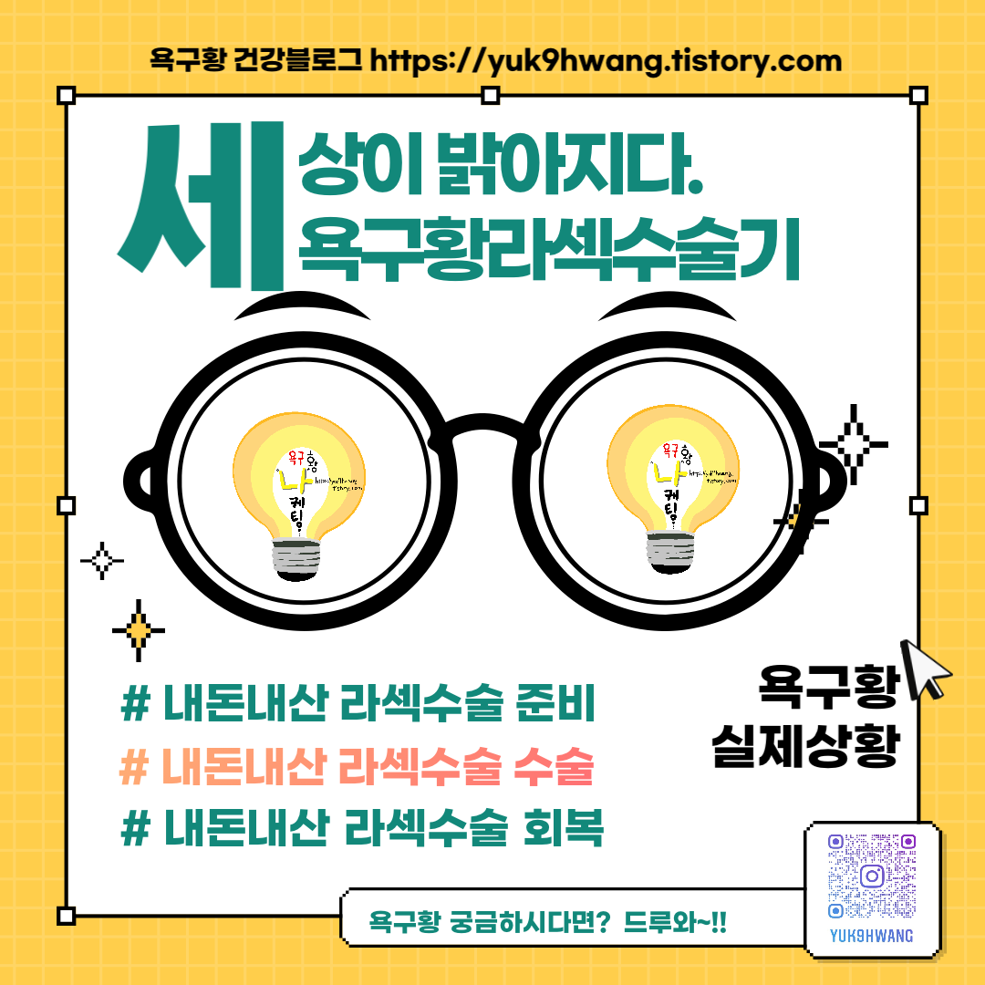 욕구황도 했다!! 라섹 무서워하지마!! 욕구황도 했다!! 라섹 무서워하지마!!