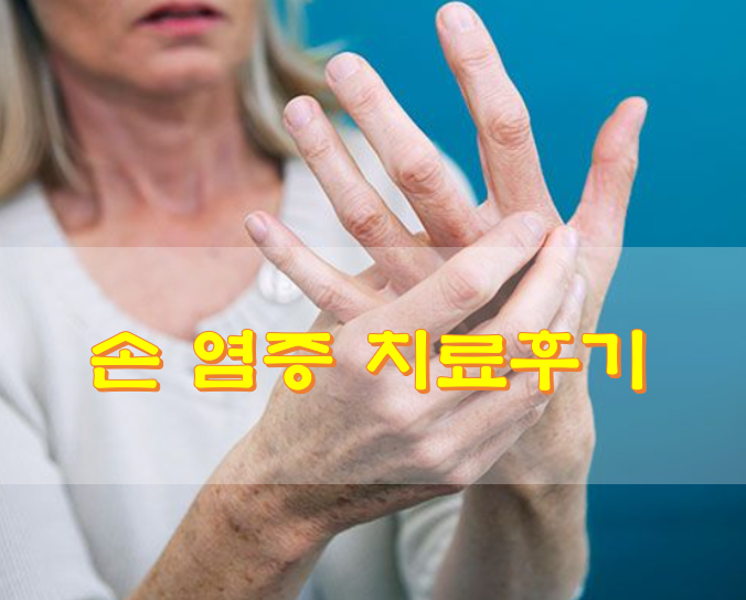  손 염증 치료 후기