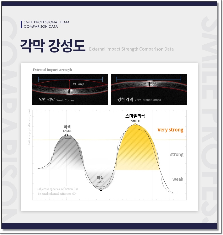 라섹회복기간 1일 9