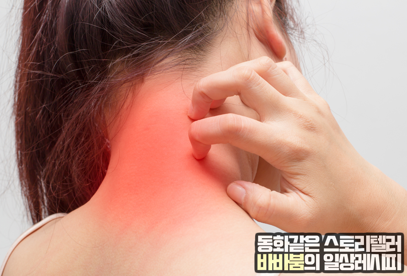  후유증이 무서운 대상포진, 증상 및 예방법!