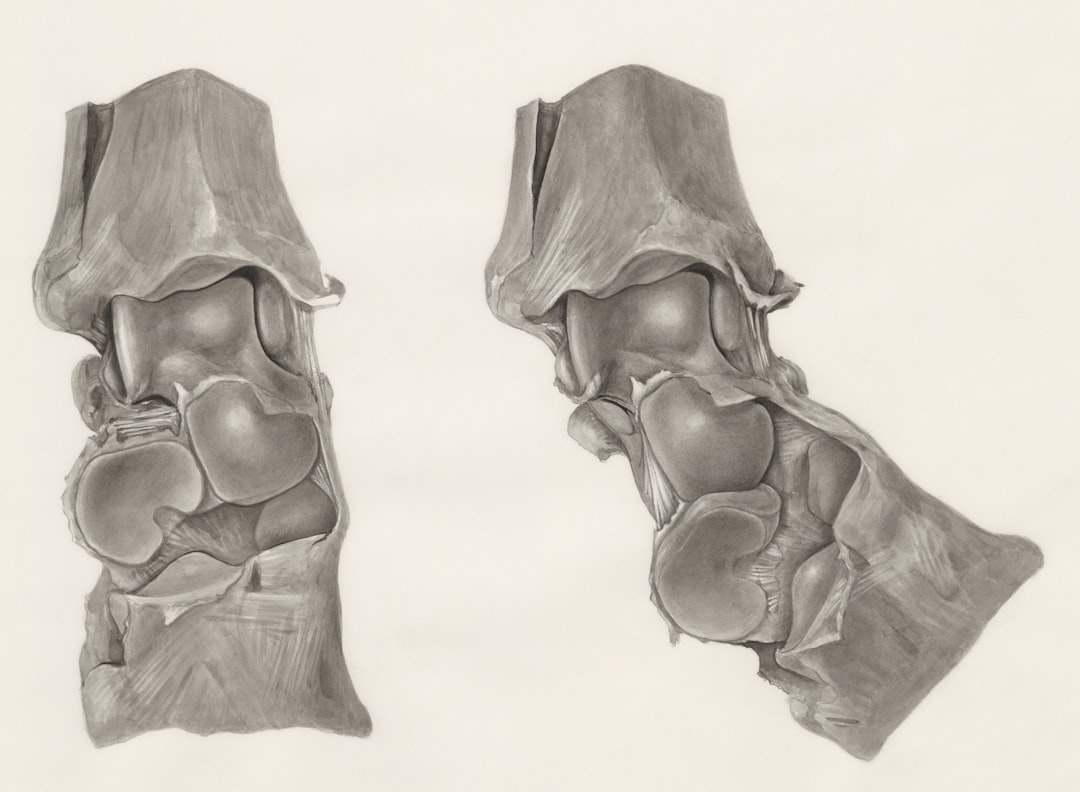 Joint pain