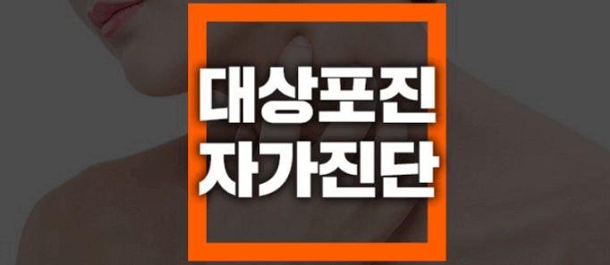 대상포진-자가진단-포스터