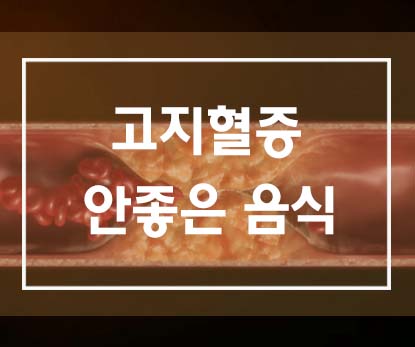  고지혈증에 안좋은 음식