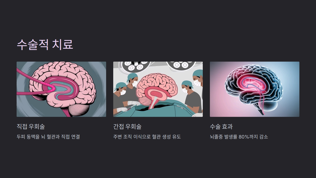 모야모야병 수명
