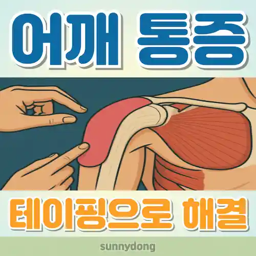 어깨 통증 테이핑 방법 썸네일