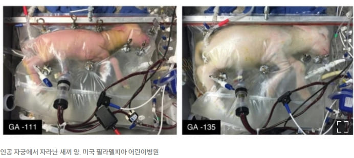 &#39;인공자궁&#39; 개발 동향...인간 실험 곧 착수...저출산 대책도 기대 Human trials of artificial wombs could start soon. Here’s what you need to know