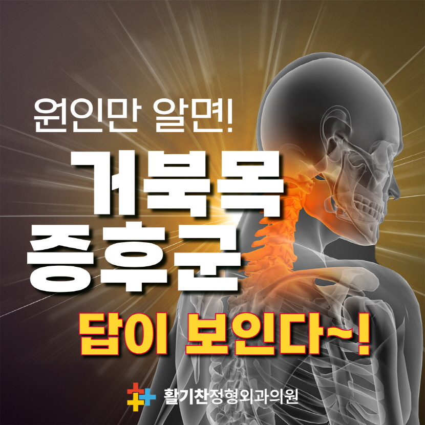 은평구목통증, 거북목증후군 증상 개선하려면?