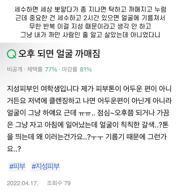 지성 피부들만 공감하는 얼굴 까매지는 현상