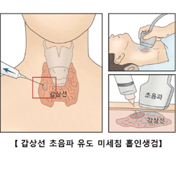 진단