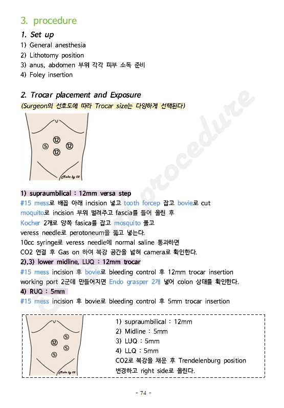 Laparoscopic Right hemicoloctomy (복강경하 우측 결장 반절제술) 수술과정 : 네이버 블로그