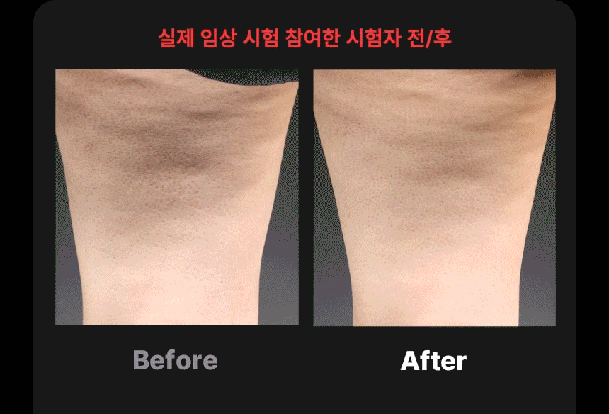 임상2