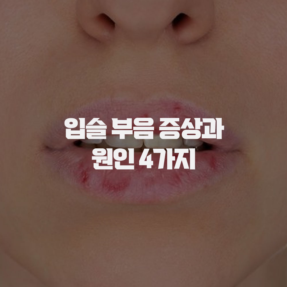  입술 부음 증상과 원인 4가지