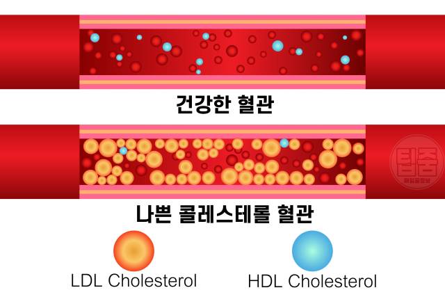 HDL콜레스테롤 높이는 음식 방법,혈관에 좋은 음식