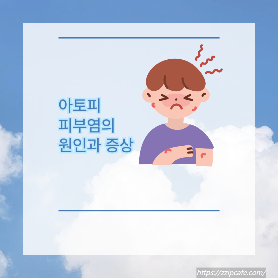 아토피 피부염