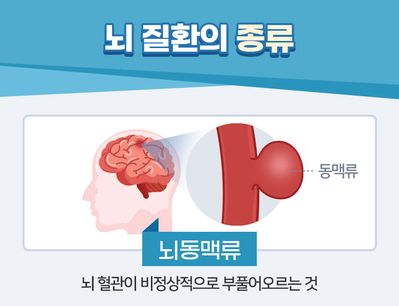 뇌동맥류 증상