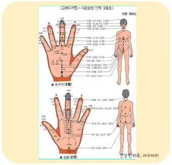 체했을때 손 따는 위치 수지침 지압점_6