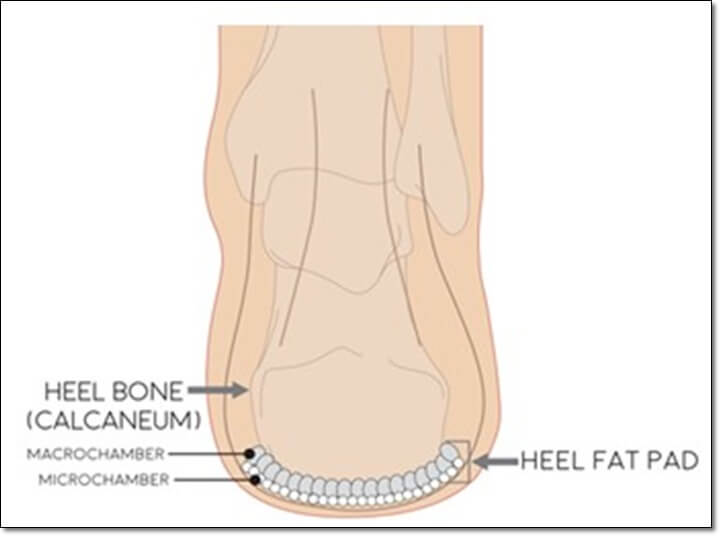 발 뒤꿈치 부위에 지방 패드의 배열을 보여주는 그림