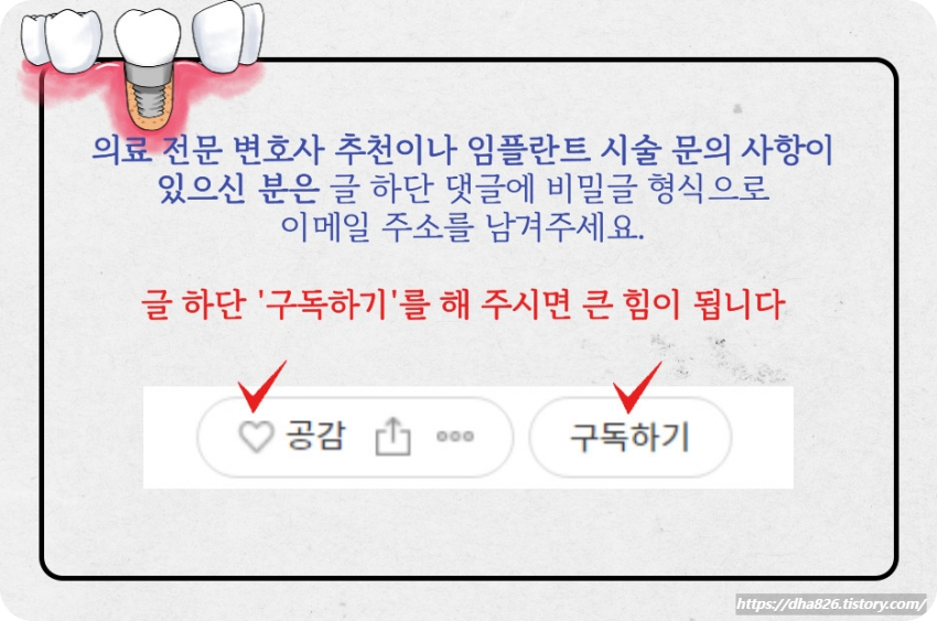 임플란트 시술 문의 사항