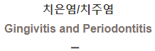  치은염/치주염 [Gingivitis and Periodontitis]