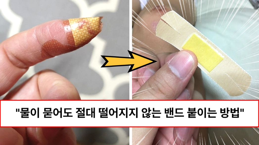 “간단하지만 절대 안 떨어집니다” 10일이 지나도 절대 떨어지지 않는 밴드 붙이는 방법