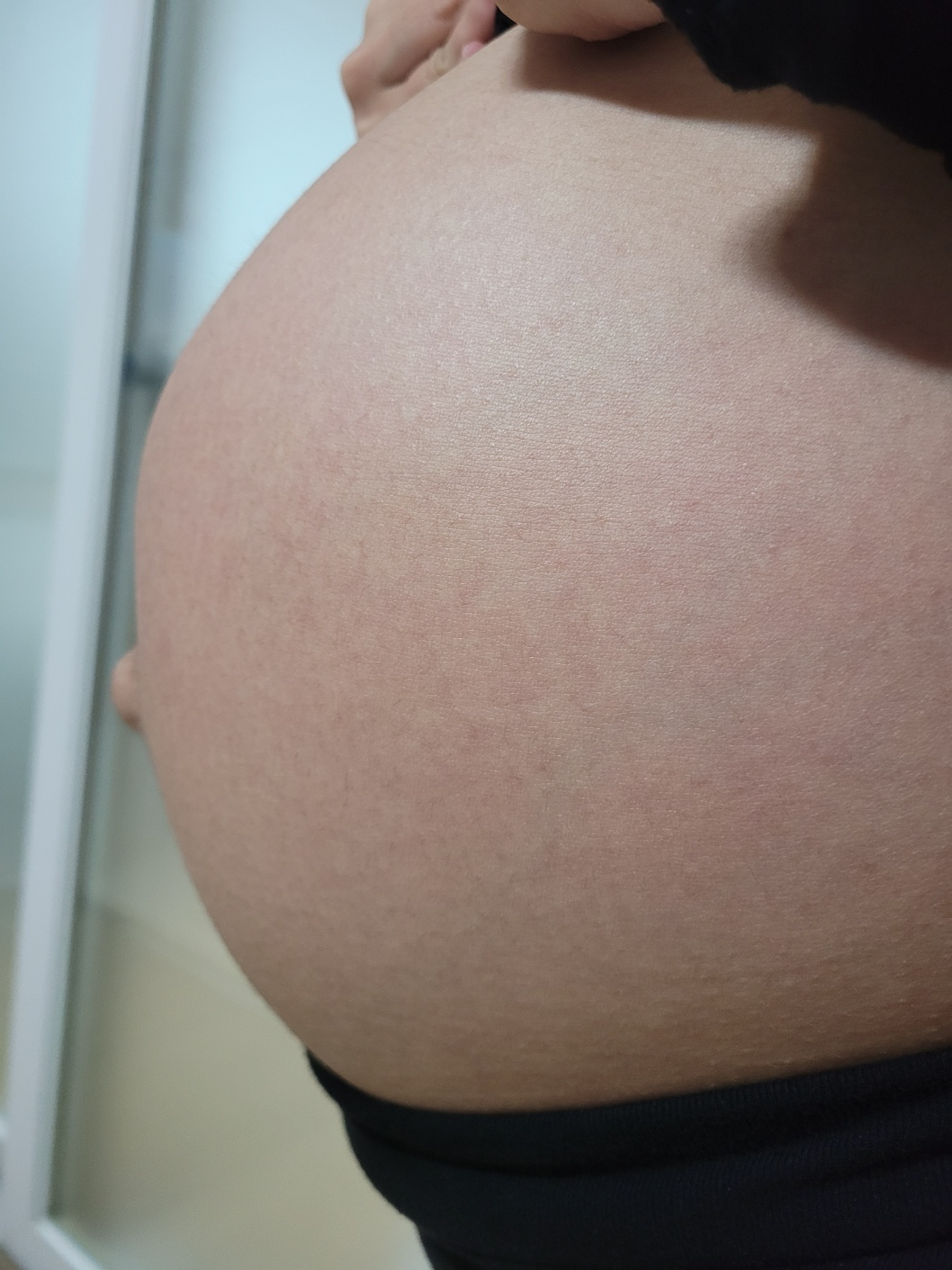  [제로이드 오인트 크림, 아베다 프로패셔널 오일]임산부 튼살 크림&오일 추천/ 분만 전까지 튼살 없는 비결