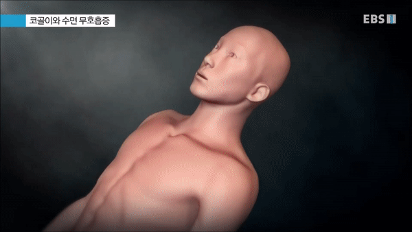  (명의) 잠의 경고, 불면과 졸음
