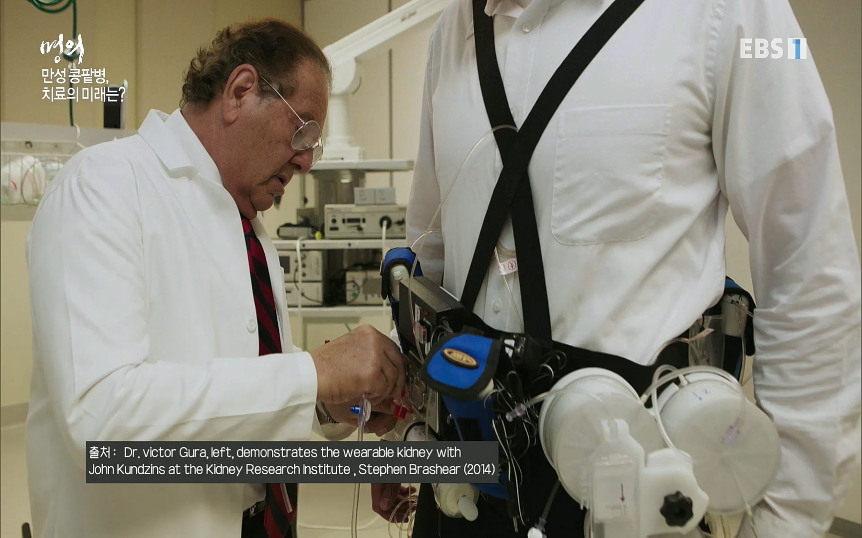 EBS 명의 헬스케어 - TV - 교육의 중심 EBS명의 15년 - 만성 콩팥병 치료, 어디까지 왔나- .mp4_20220802_205736.493.jpg
