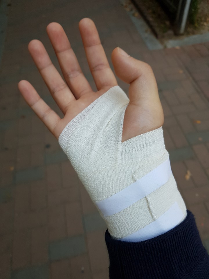 손목결절종 수술 대신 손목보호대로 나은 후기 4