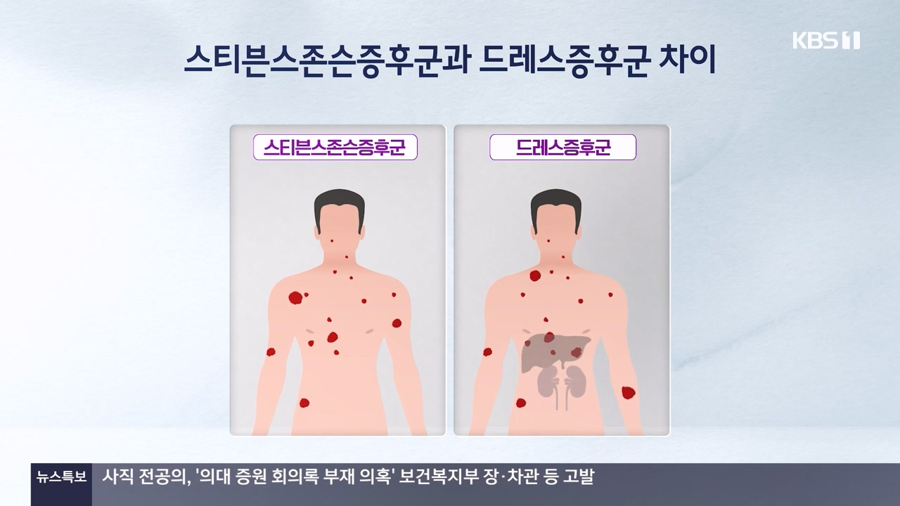 생로병사의 비밀.E910.240509p-NEXT.mp4_20240509_202514.471.jpg