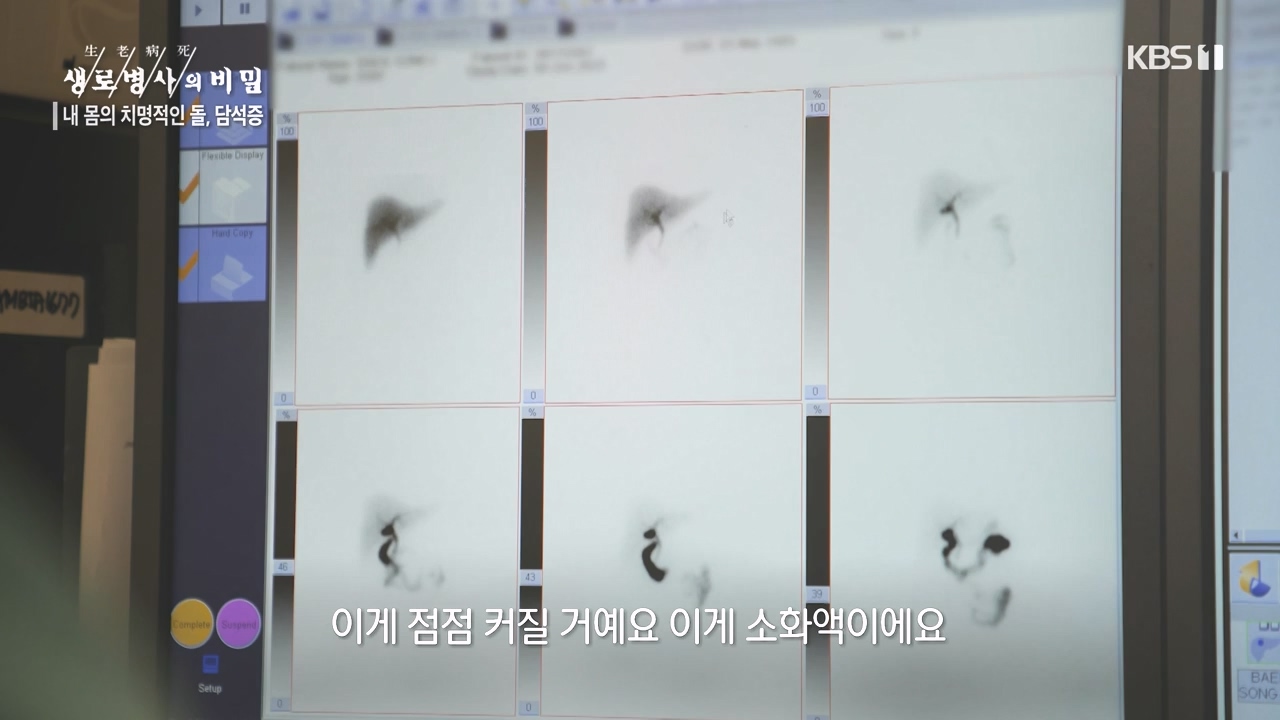 생로병사의 비밀.E886.231019p-NEXT.mp4_20231019_203453.026.jpg