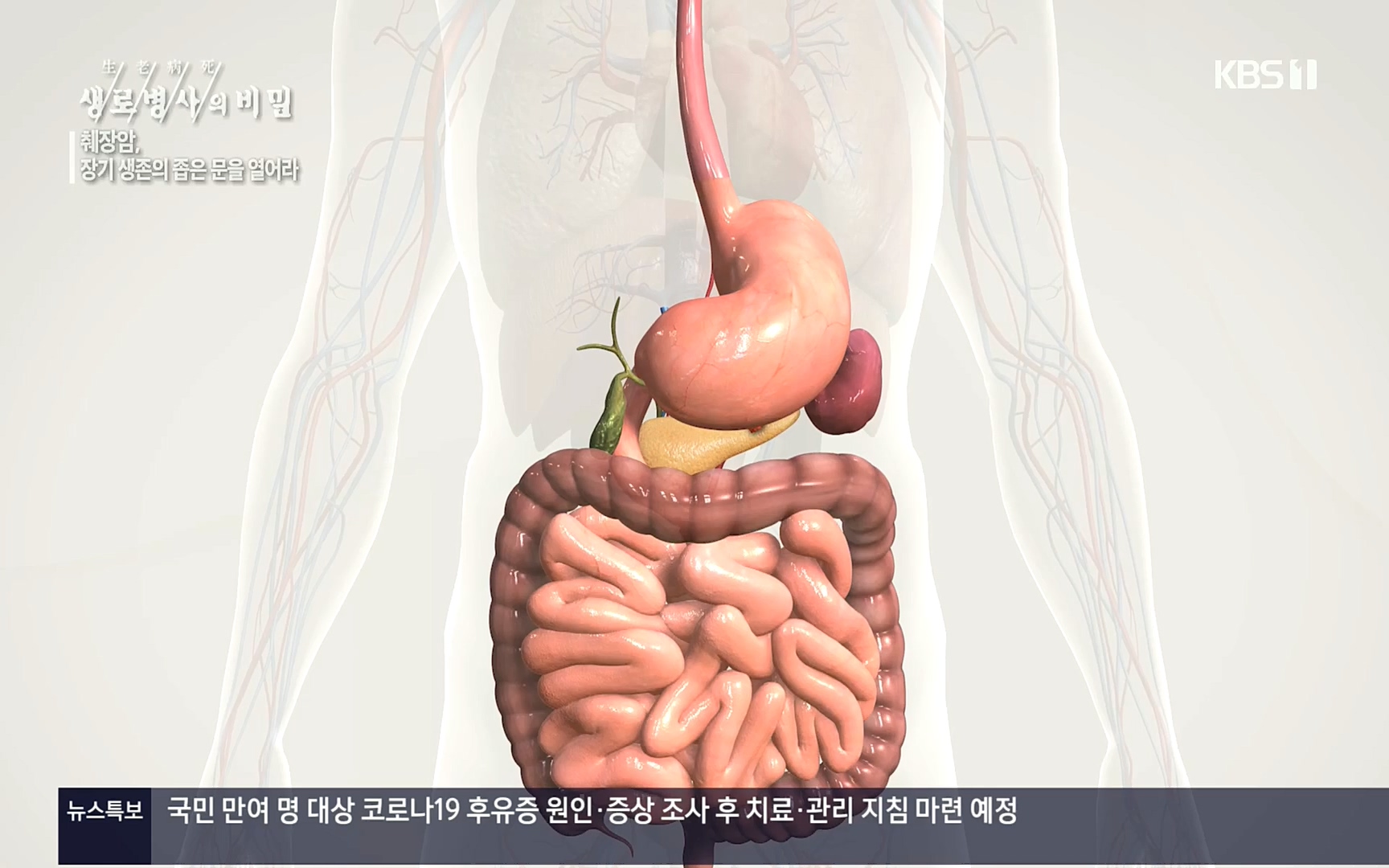 생로병사의 비밀.E823.220622p.H264-F1RST.mp4_20220624_210517.149.jpg