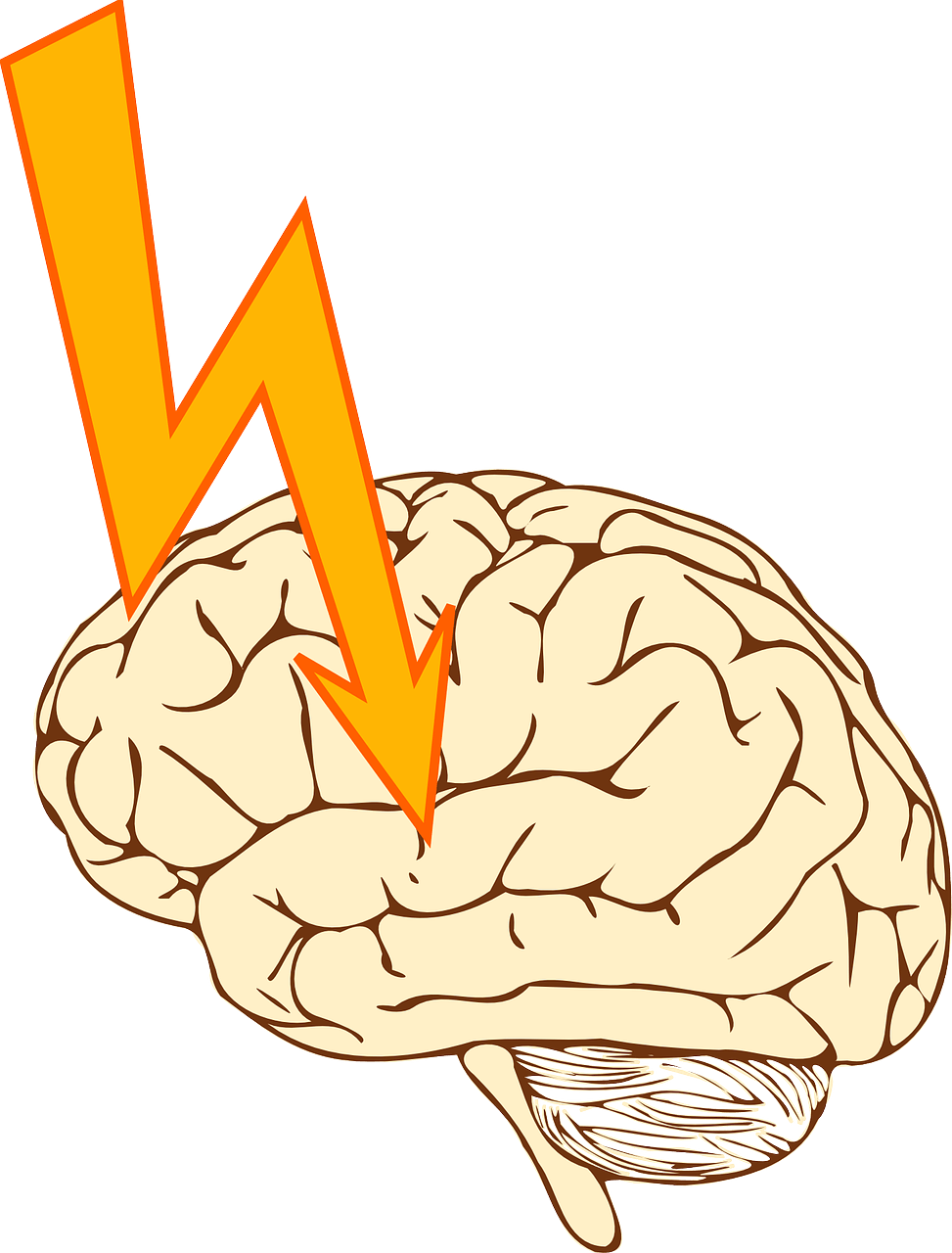 cerebral-infarction