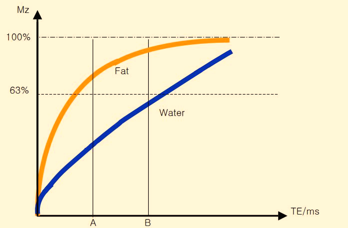  MR image parameter. 고유인자 (T1 weighted image)